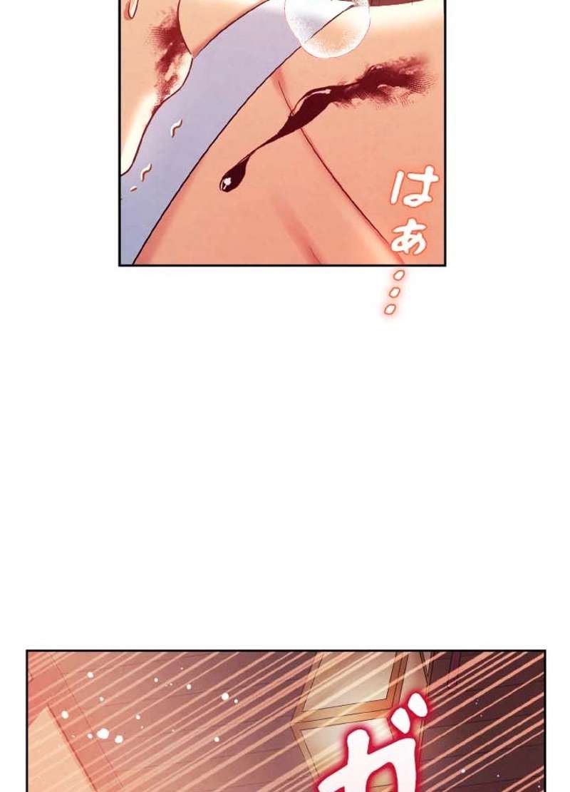 P75