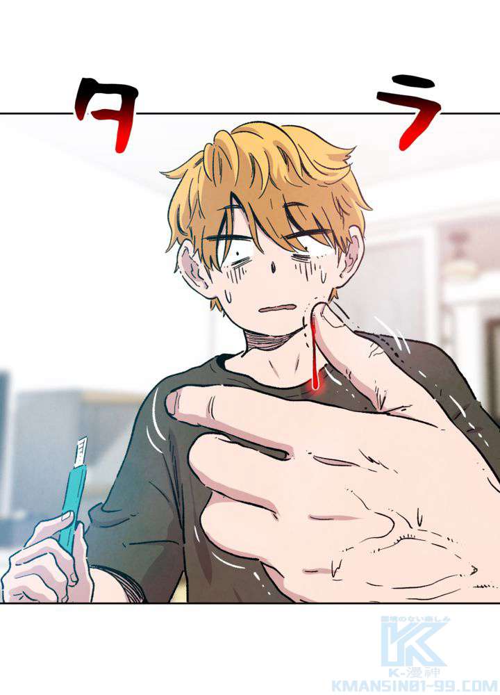 P172