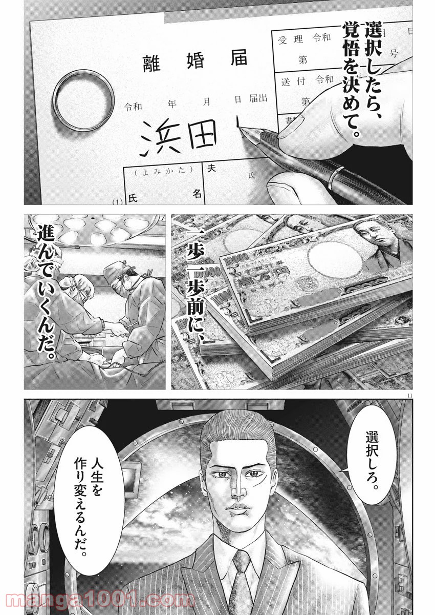 P11