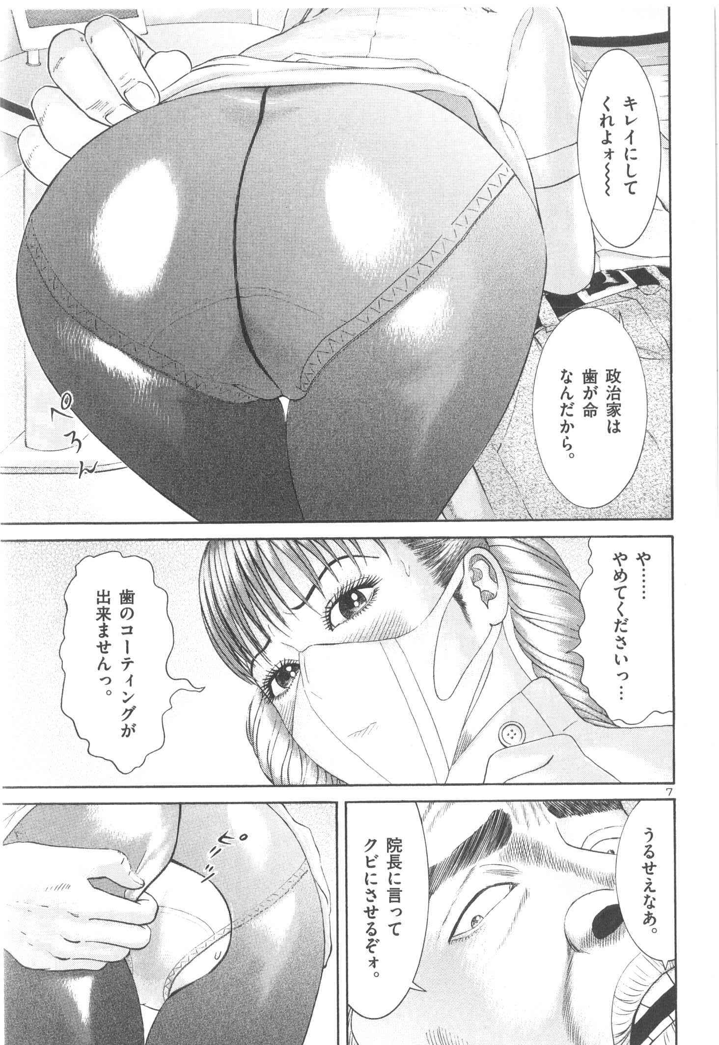 P155