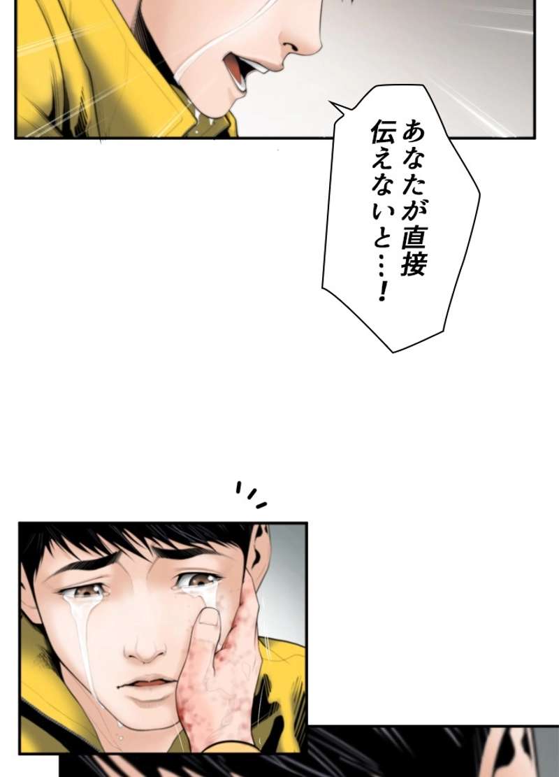 P62