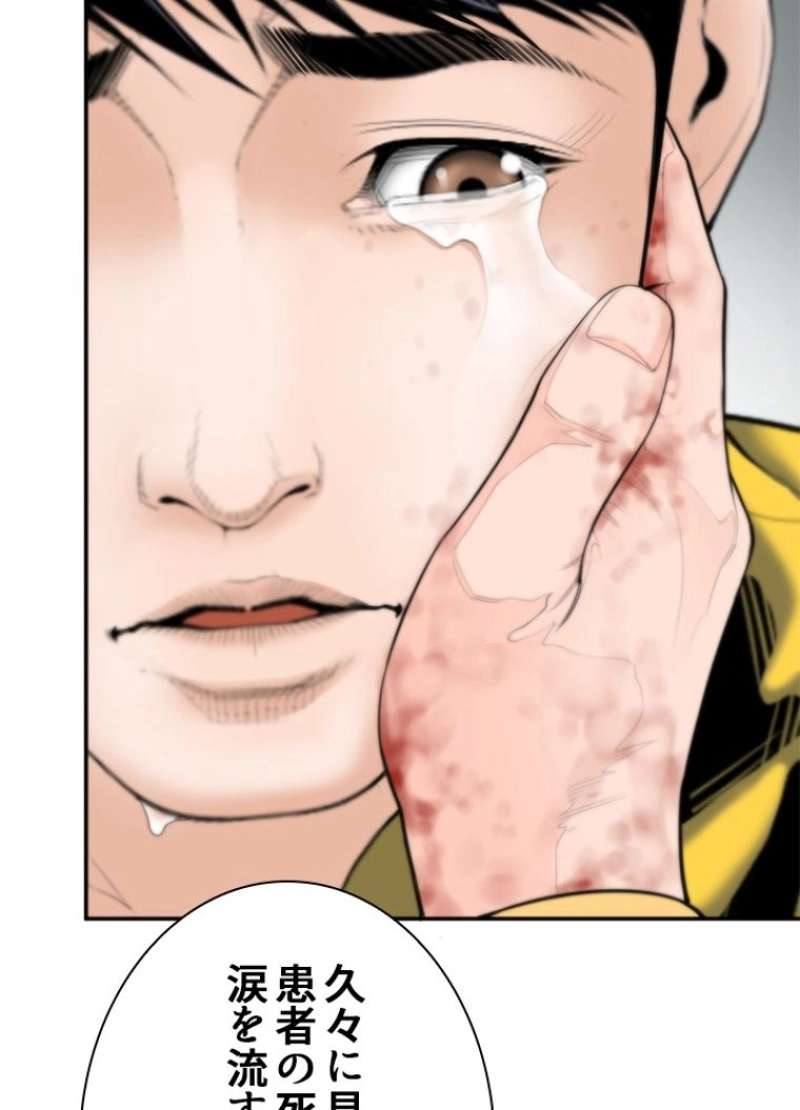 P63