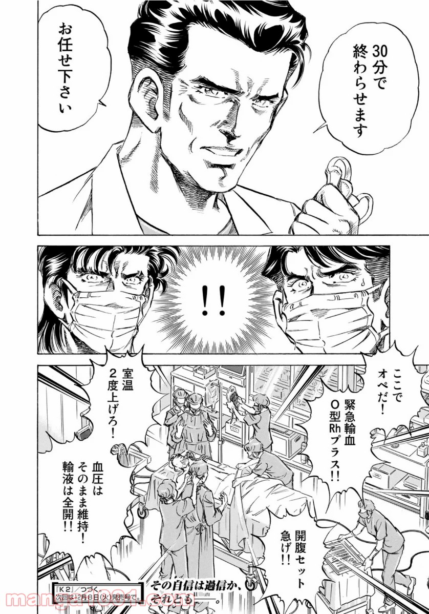 P20