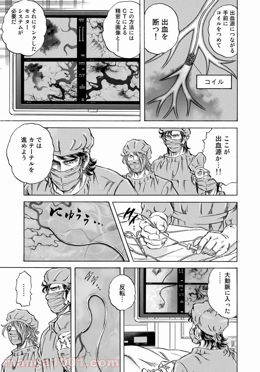 P15