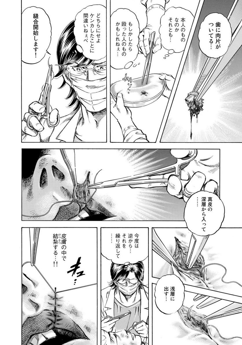 P12