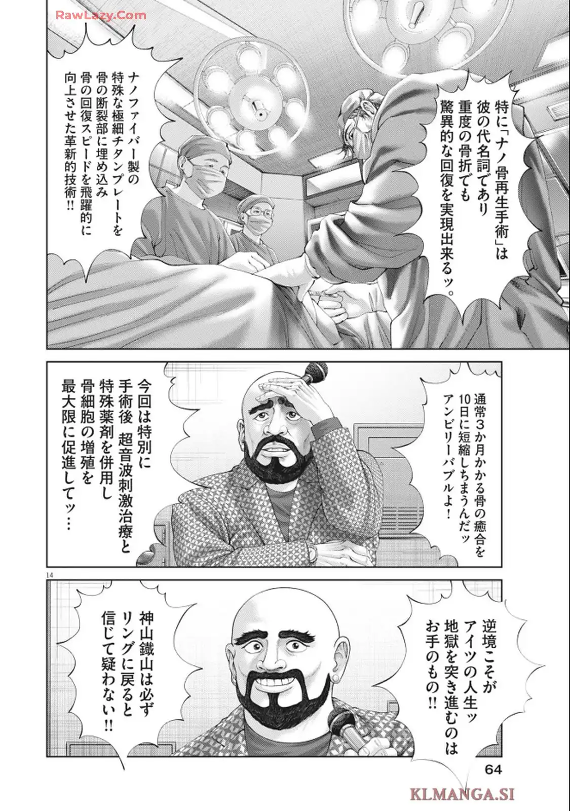 P14