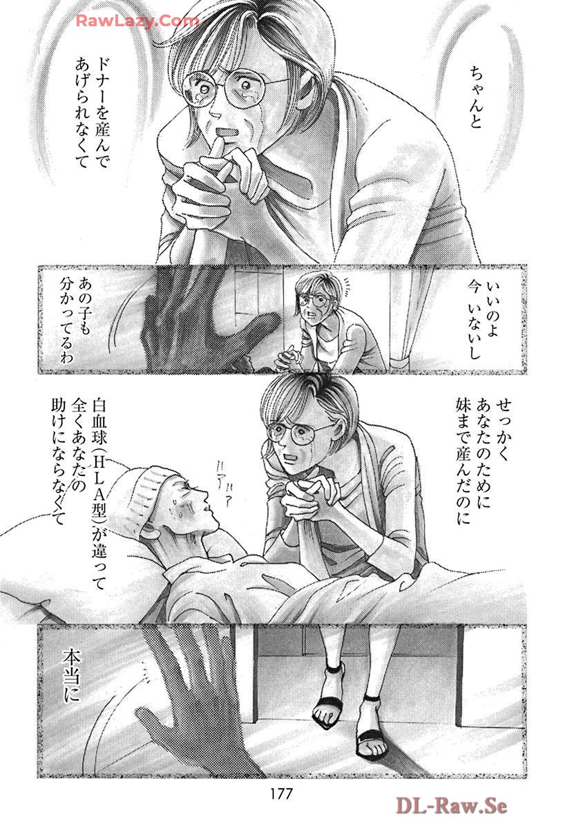 P32