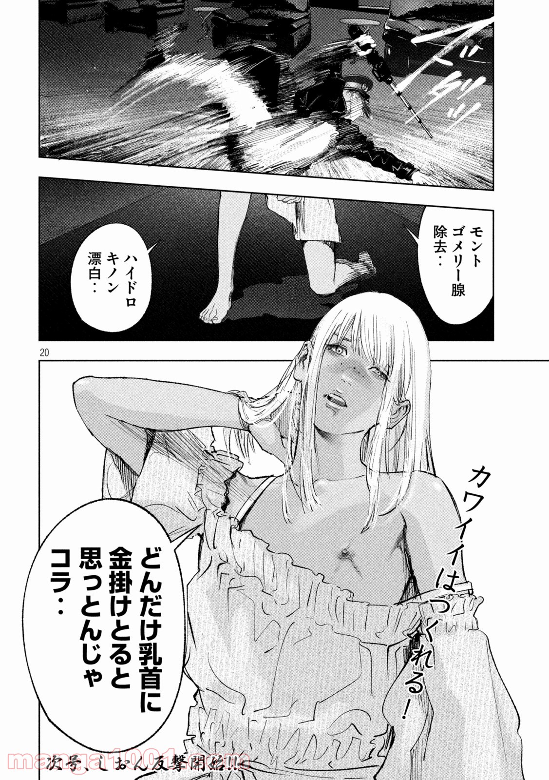 P20