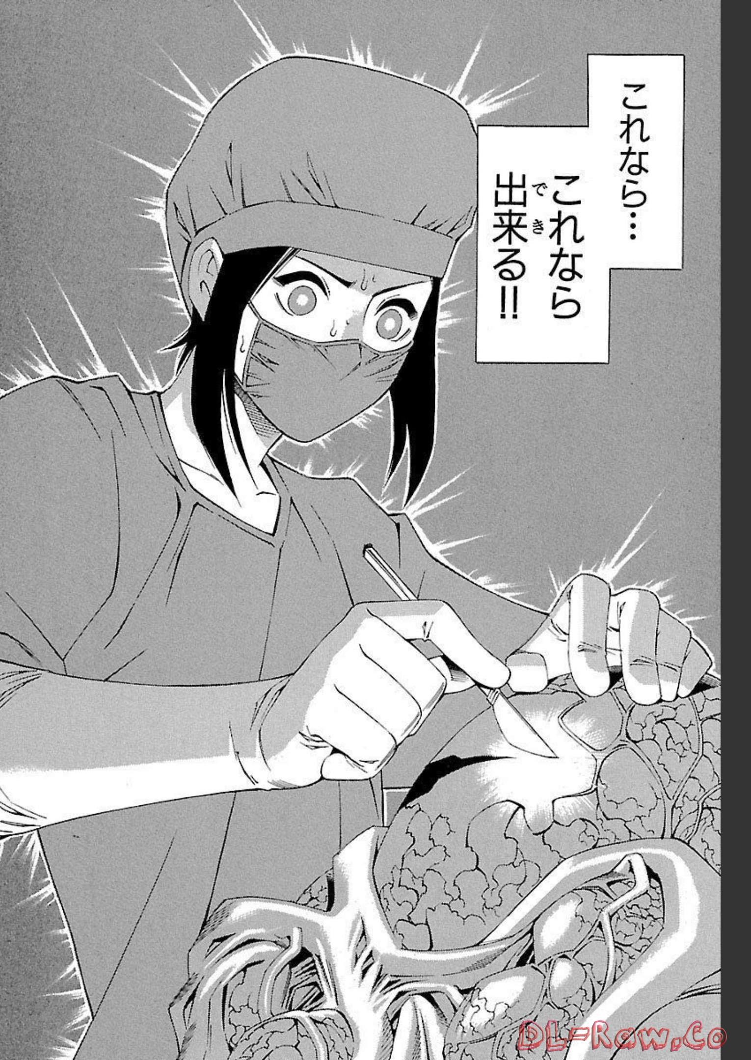 P32
