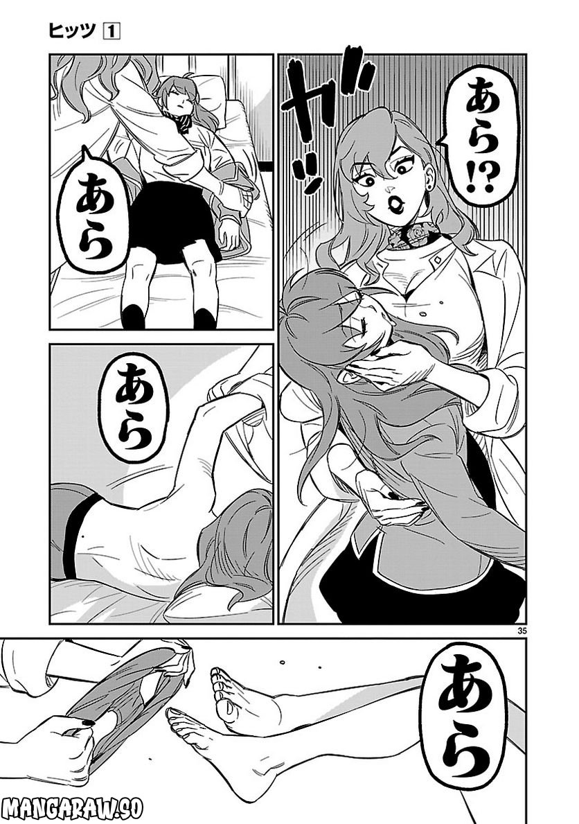 P35