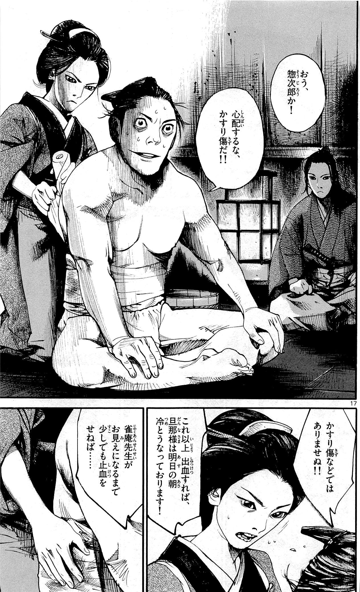 P151
