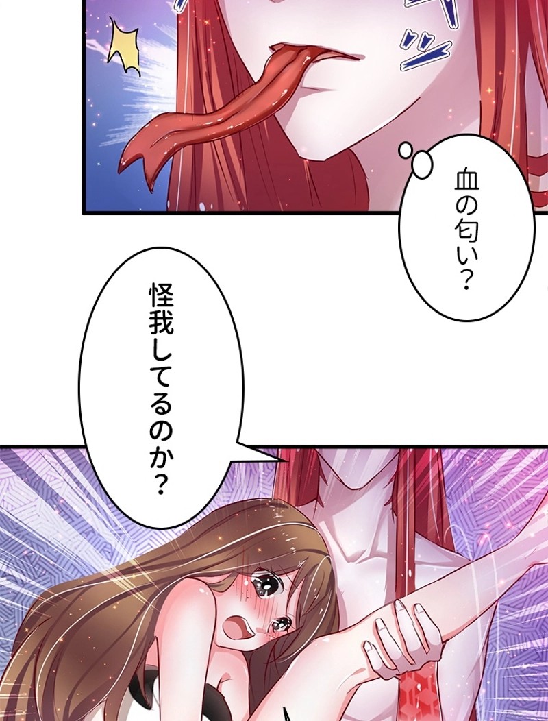 P35