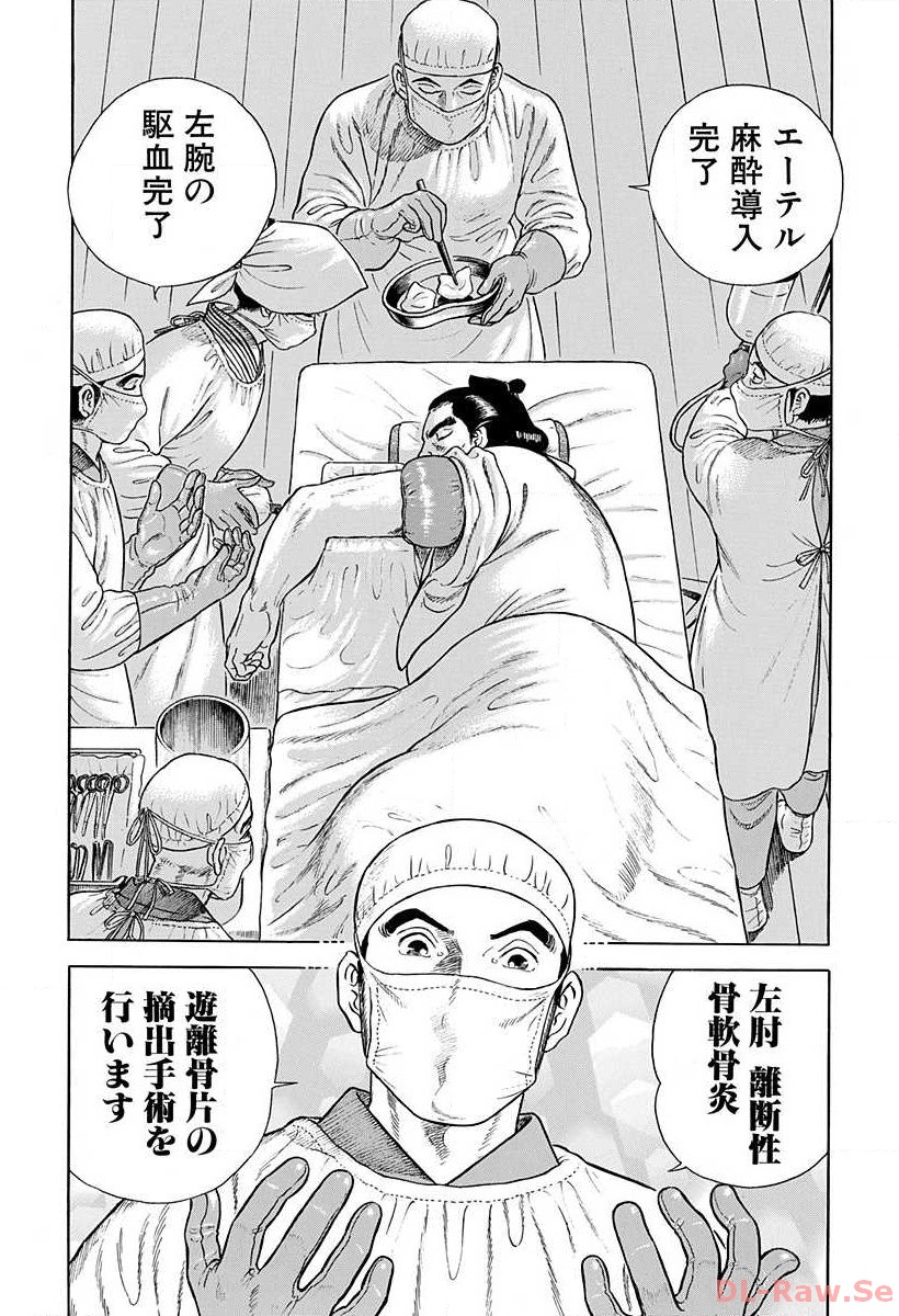 P14