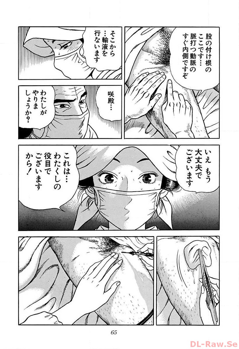P29