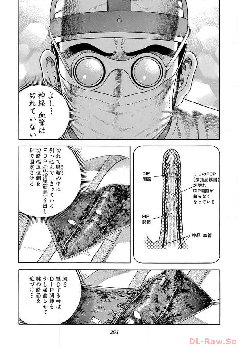 P41