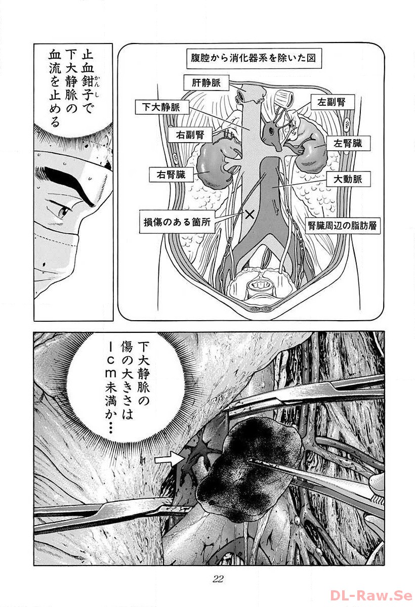 P18
