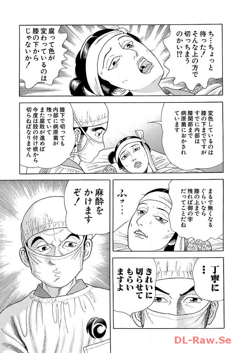 P51
