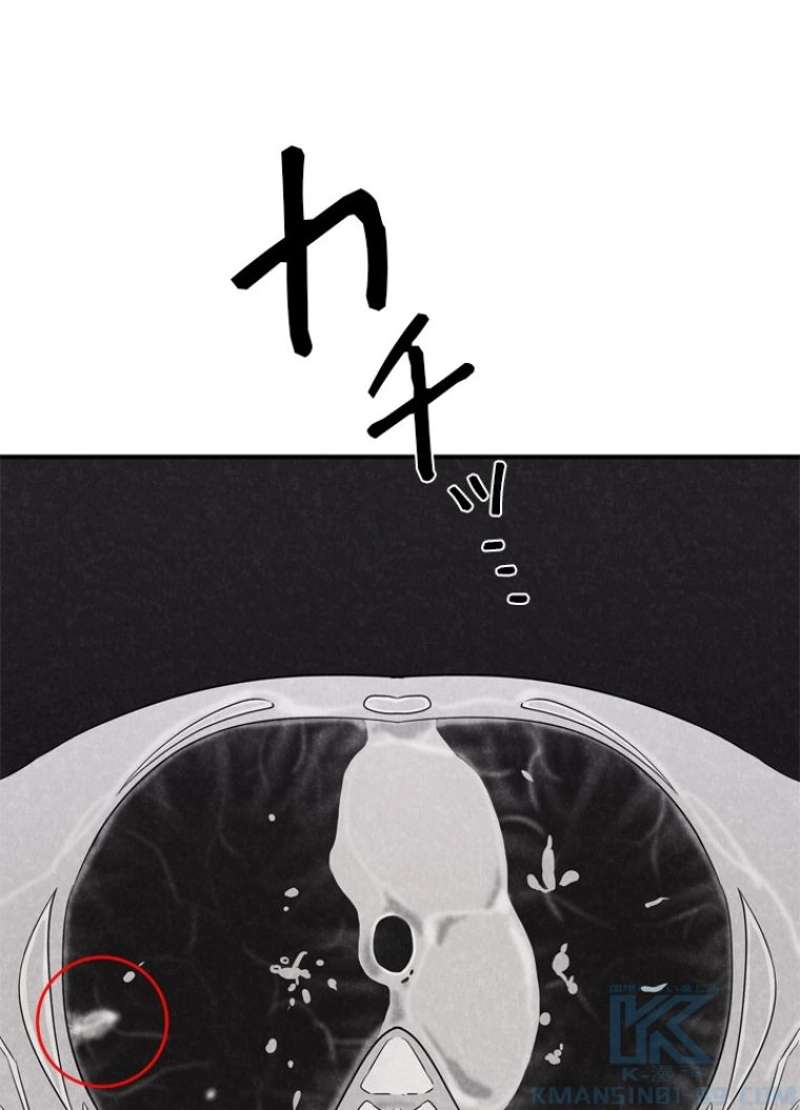 P65