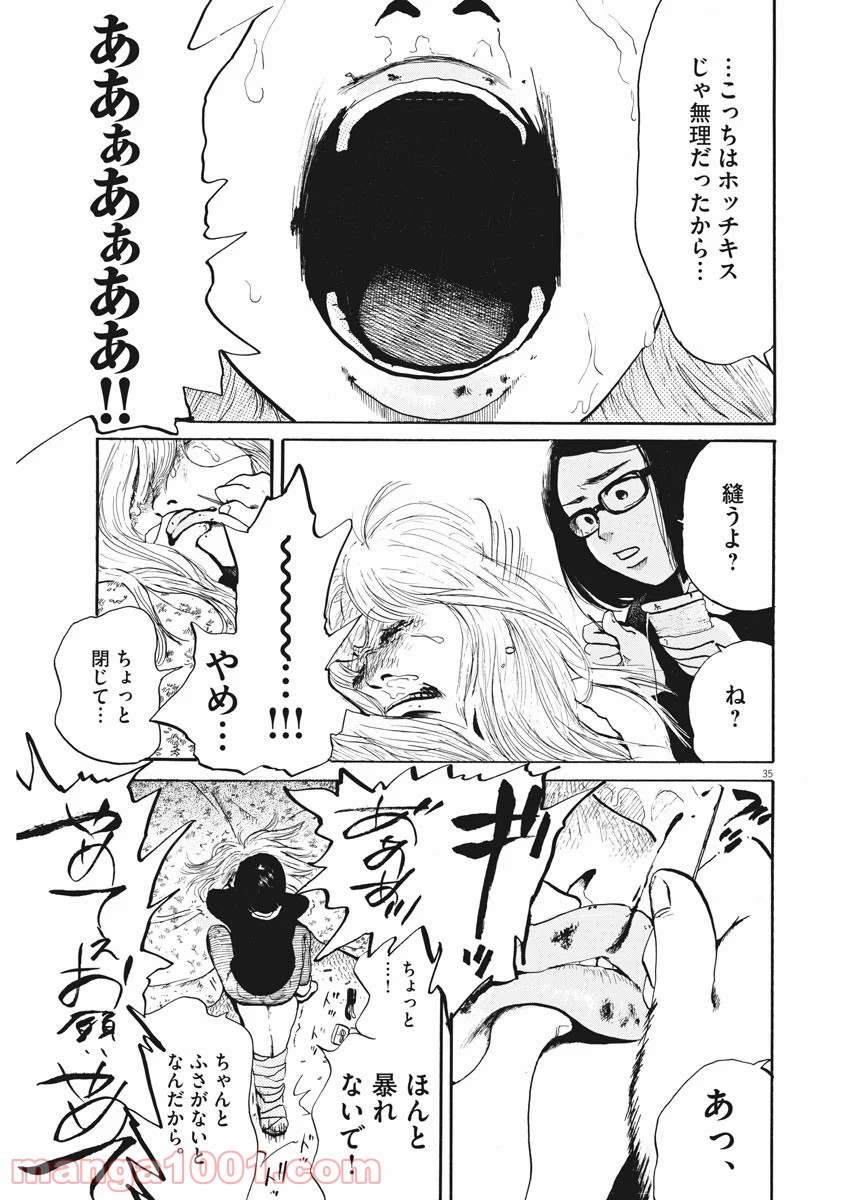 P35
