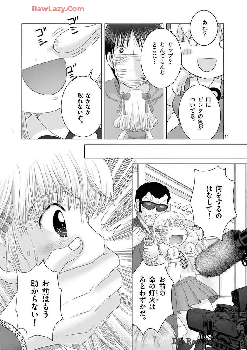P11