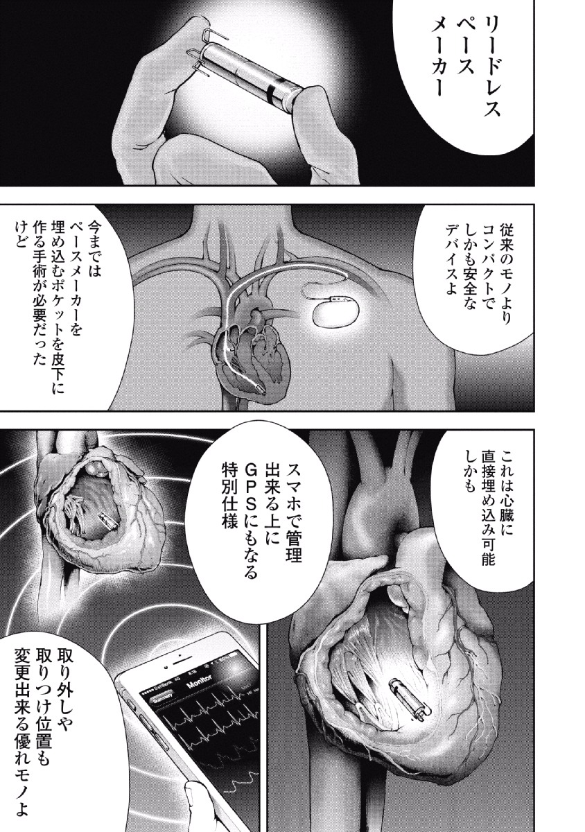 P103