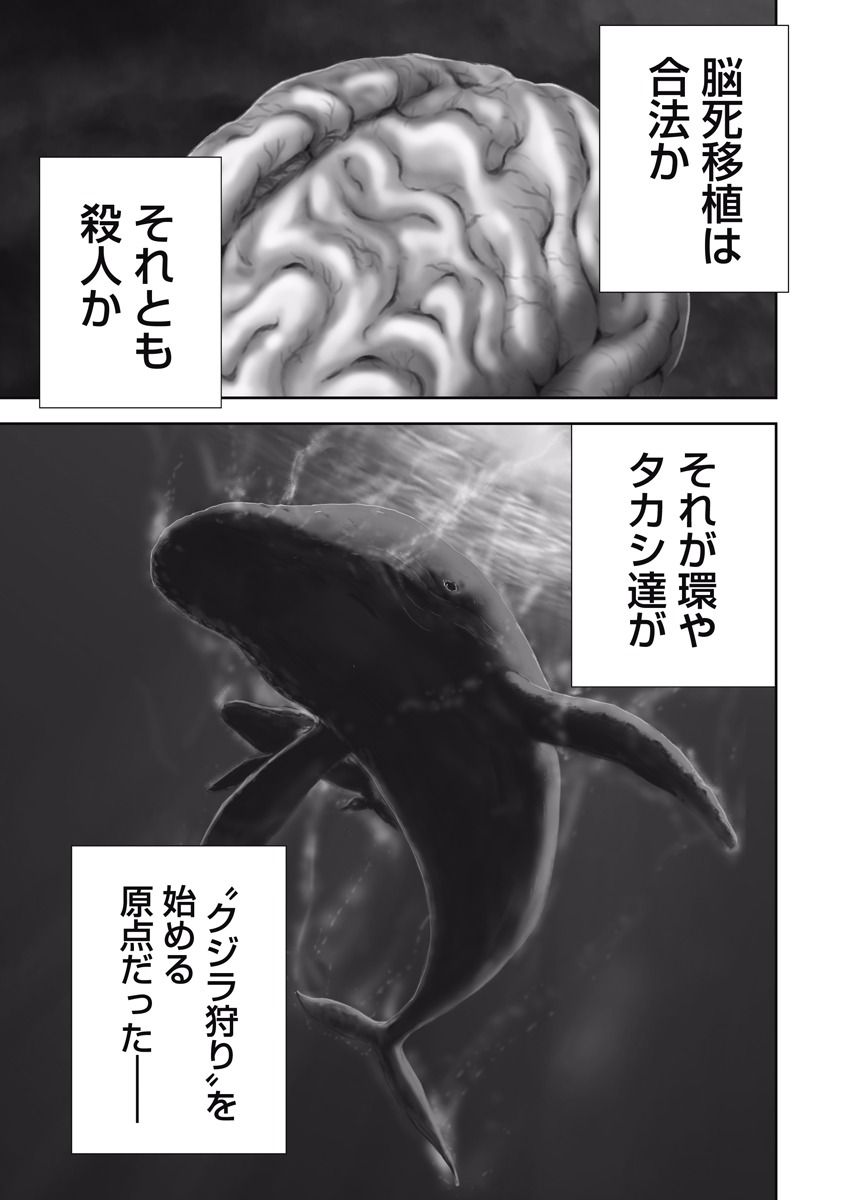 P87