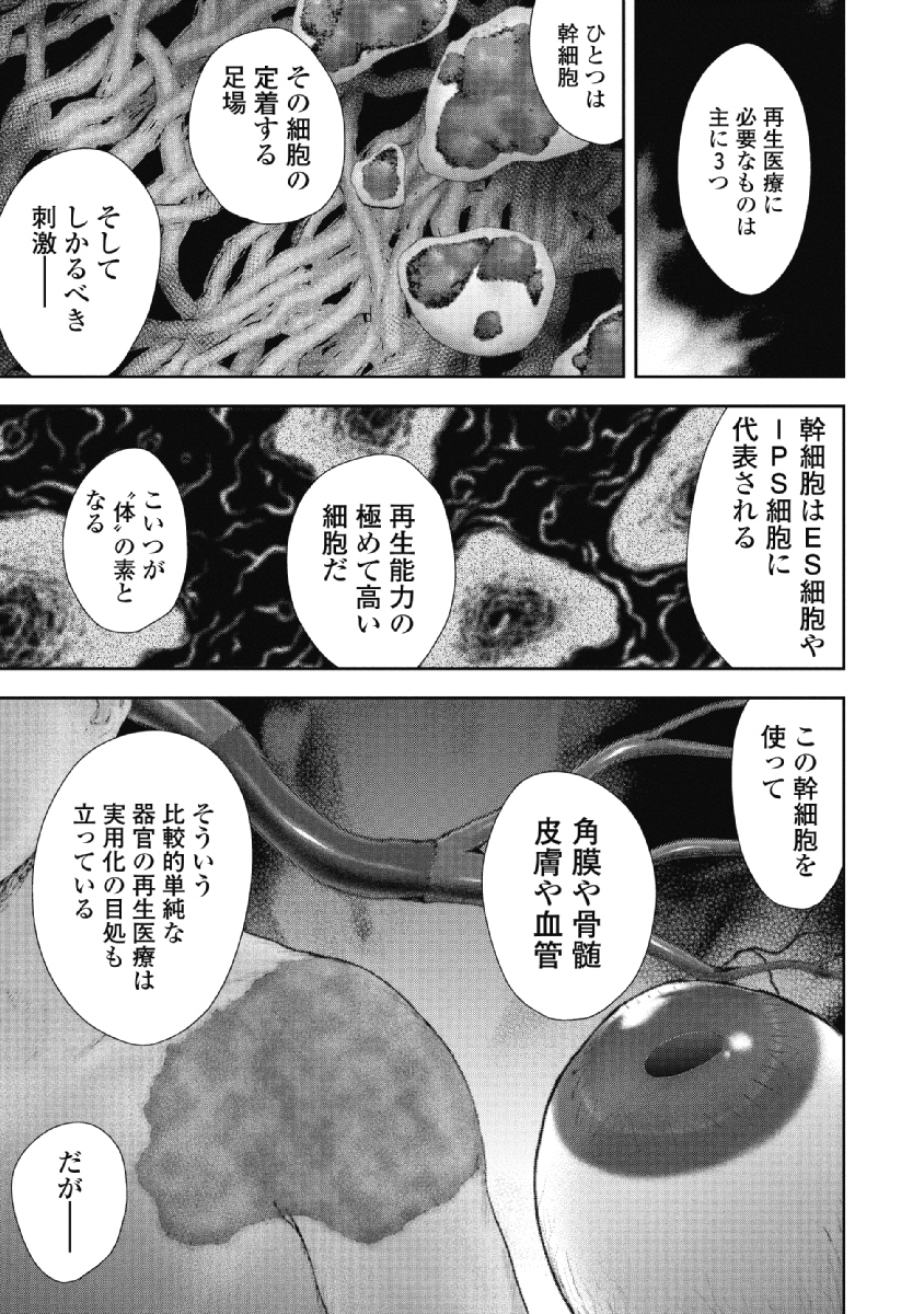P115