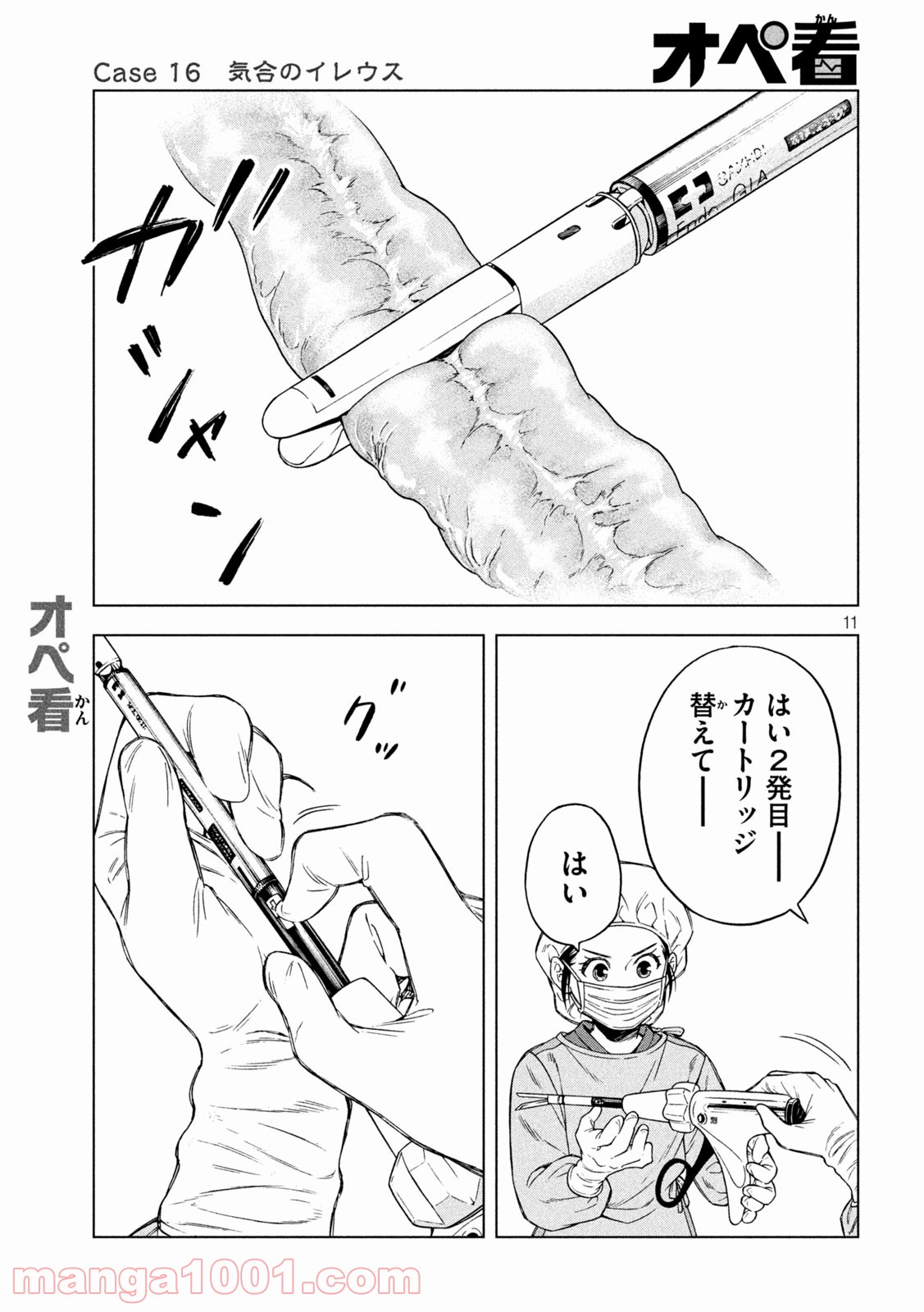 P11