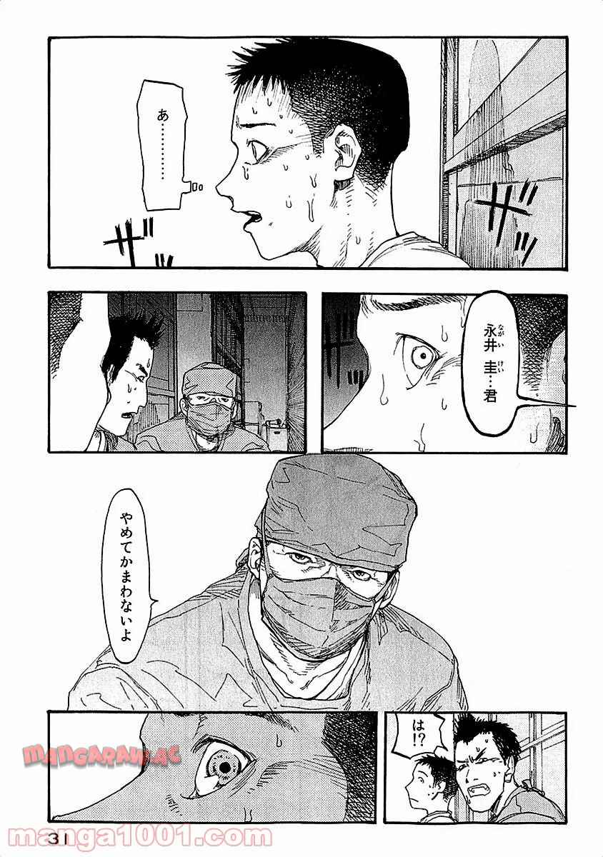 P32