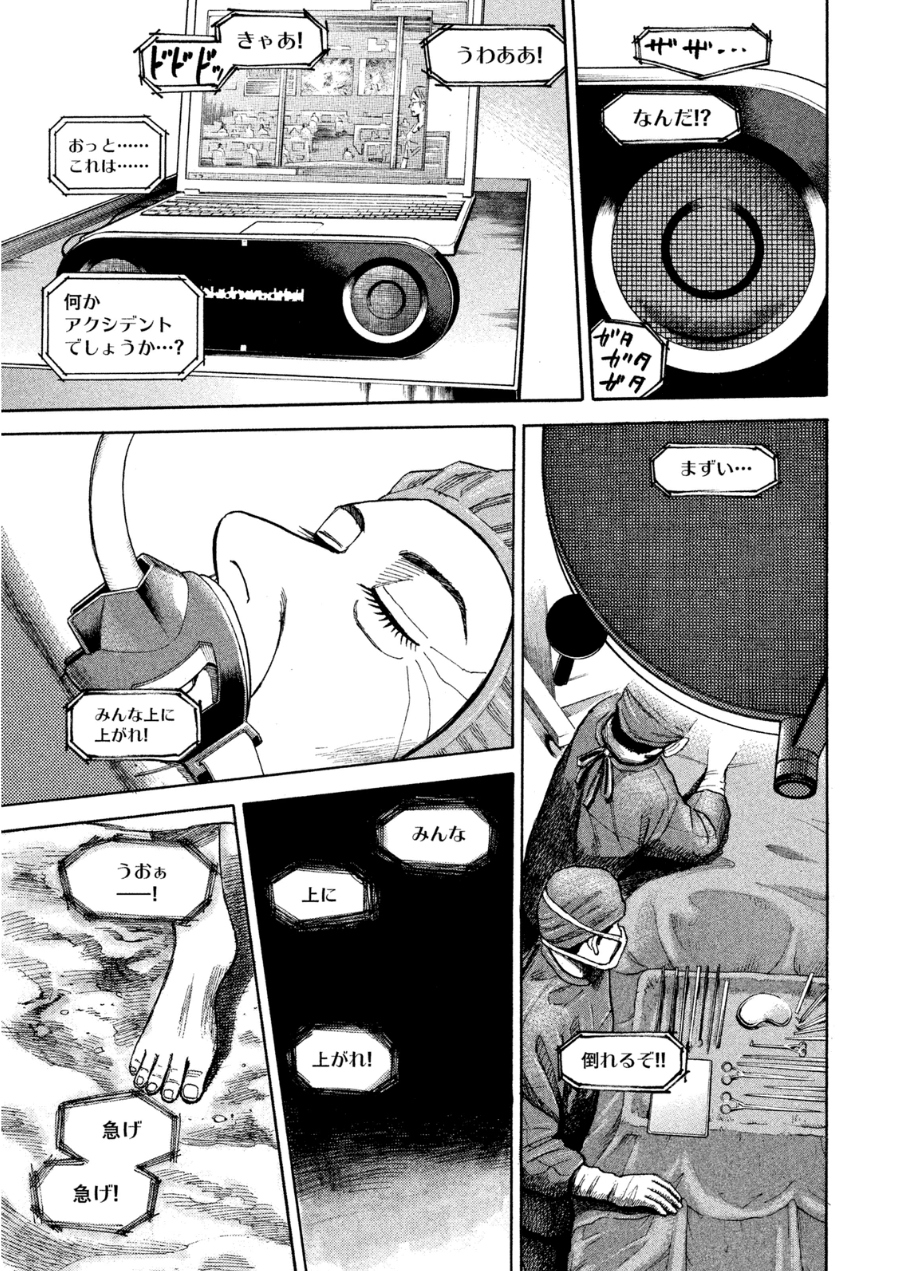 P115